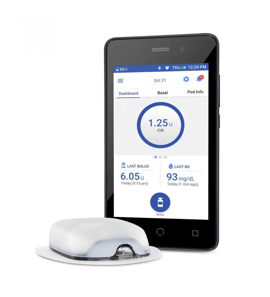 Come può l’Omnipod facilitare la vita di un diabetico di tipo 1?