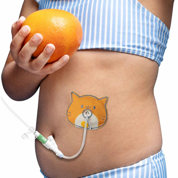 pediatric g tube protective pad worn by child soft cushion for stoma protection and comfortable daily use