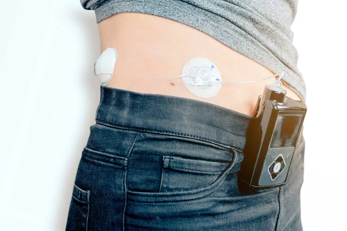 The Closed-Loop System for Diabetes Immagine