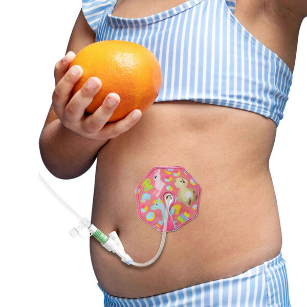 Cuscinetti per gastrostomia per bambini – Fantasie colorate e comfort delicato | Kaio-Tube Pads