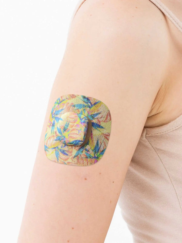 medtronic simplera overpatch with tropical print worn on arm for secure sensor fixation during daily activity
