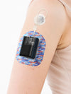 Flow Camo Tandem Mobi patch worn on the upper arm over the Dia-Mobi Clip